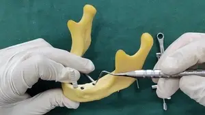 BLE Angled Abutment