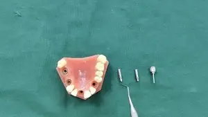 BLE Temporary Abutment