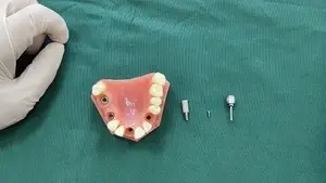 BLE Screw-Retained Abutment