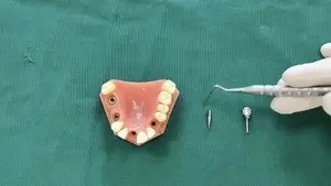 BLE Angled Abutment