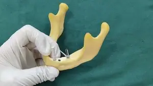 BLE Multi-unit Temporary Abutment