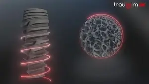 NT Dental Implant System