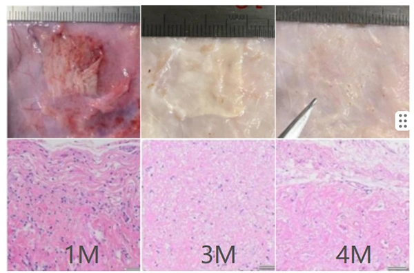 Dental Collagen Membrane