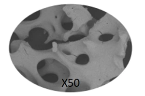 Xeno Bone Graft