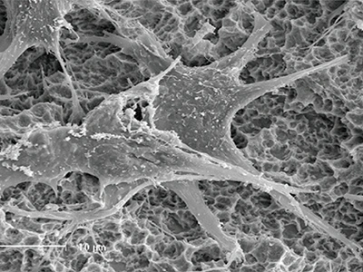 Cell pseudopodia attachment